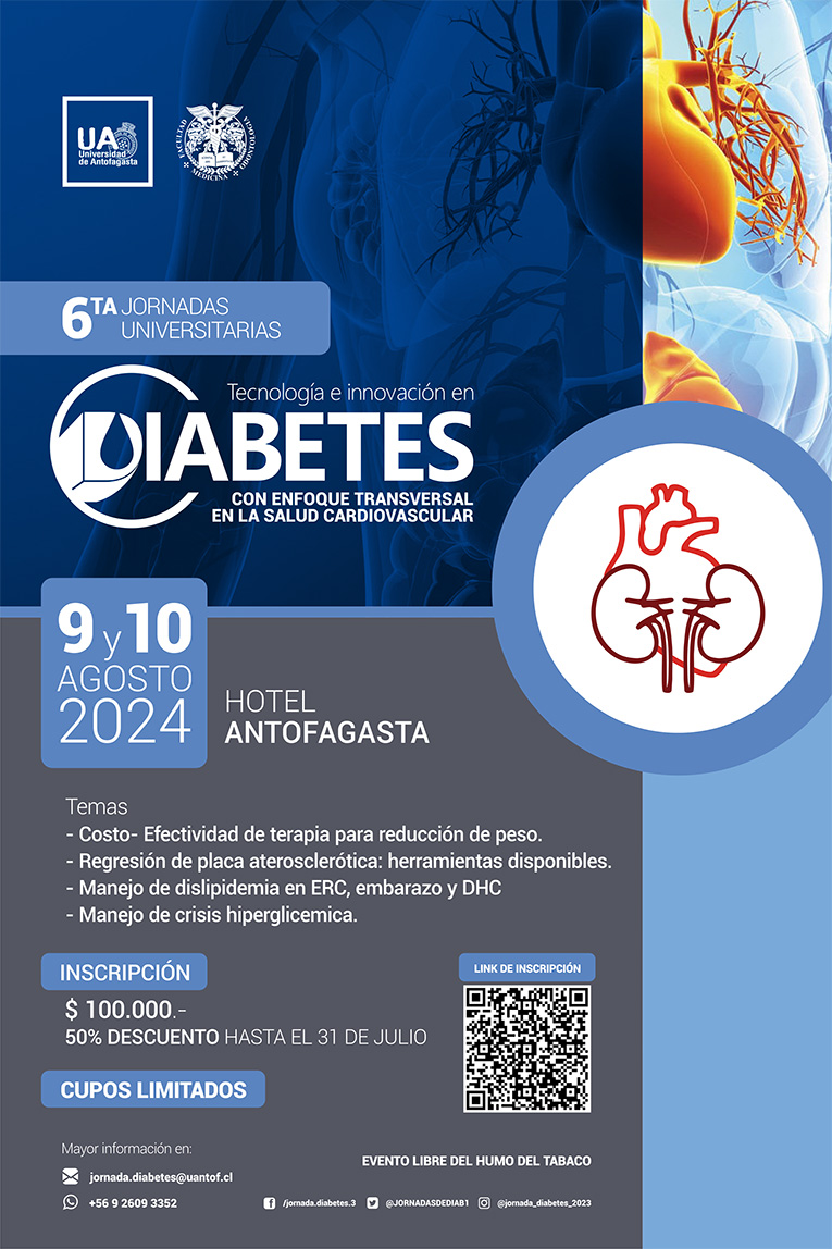 Evento