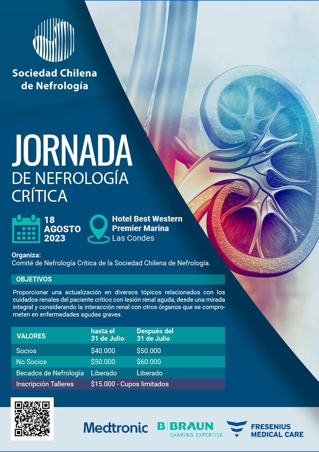 Evento