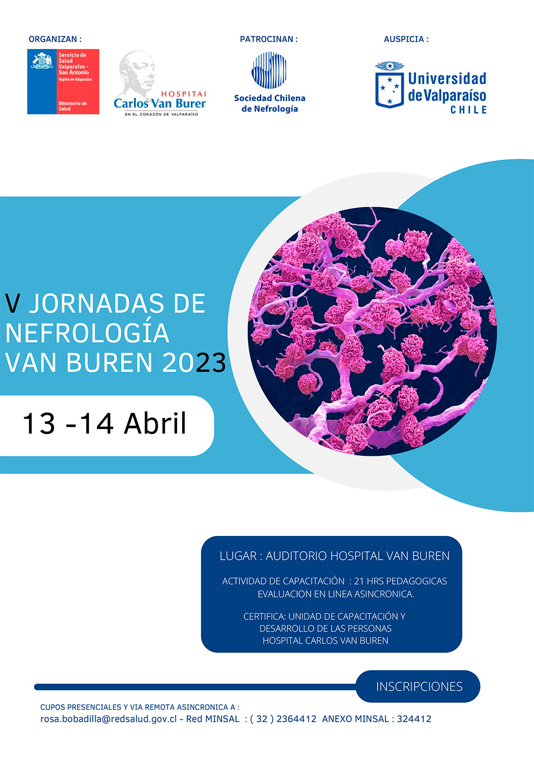 Evento