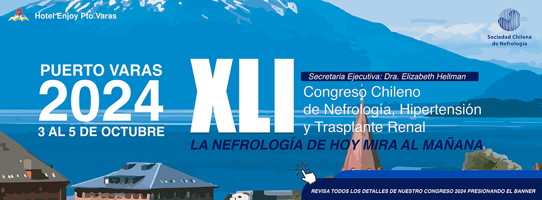 Evento