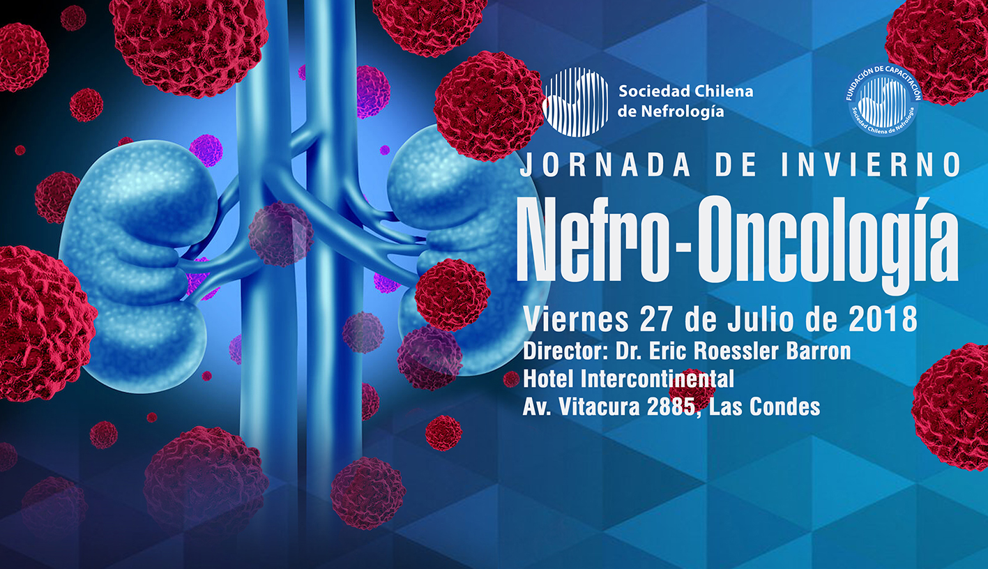 Evento