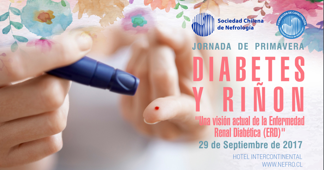 Evento