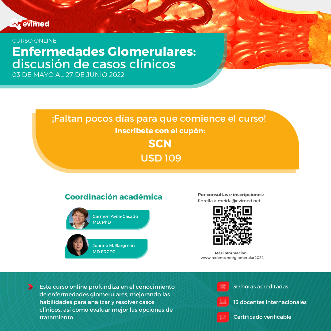 Evento