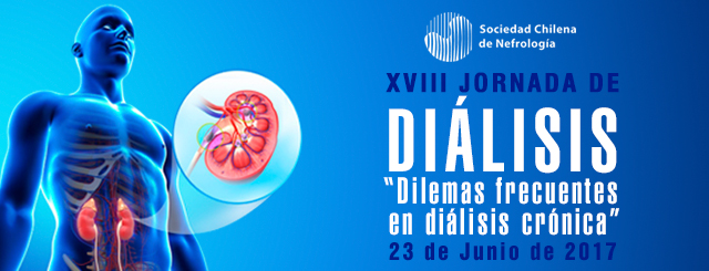 Evento