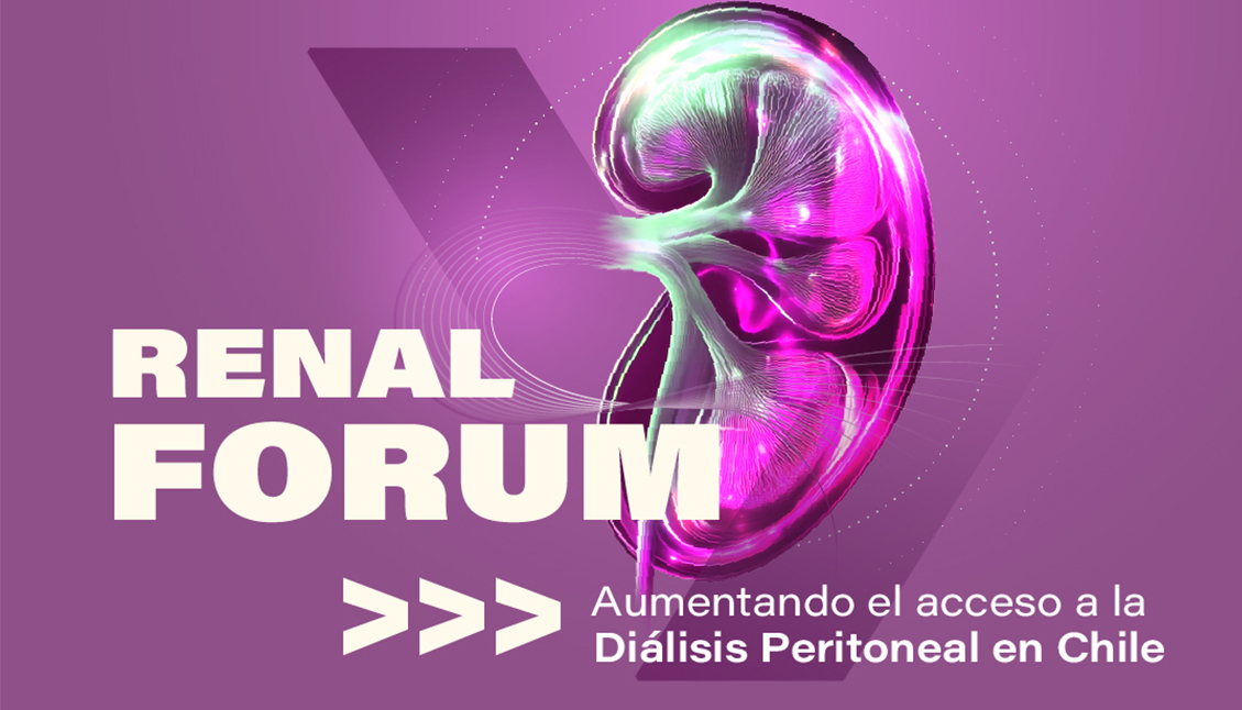 Evento