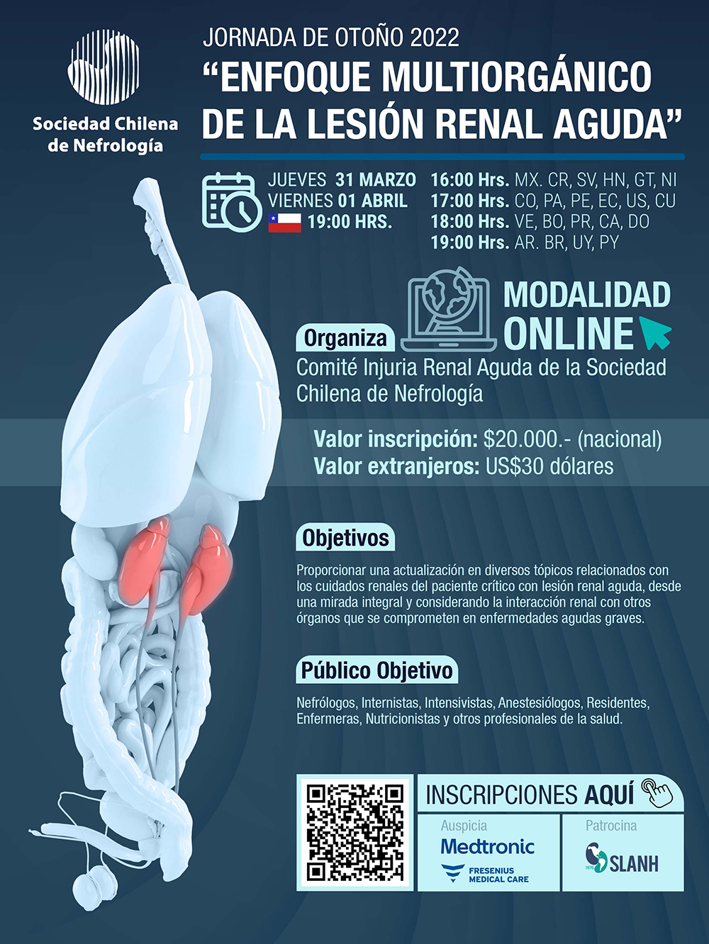 Evento