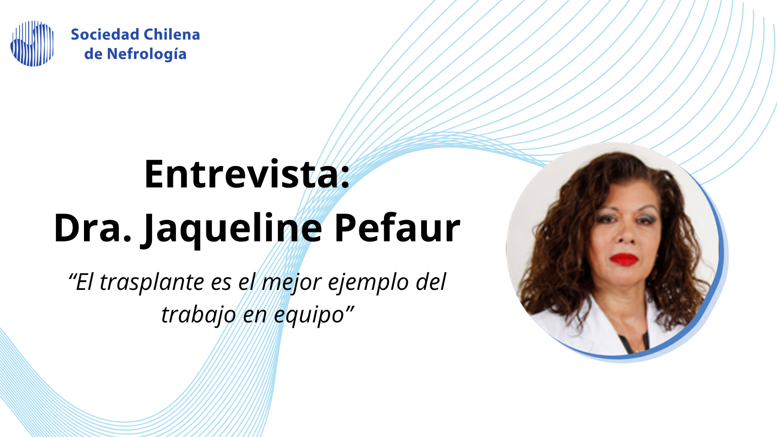 Evento