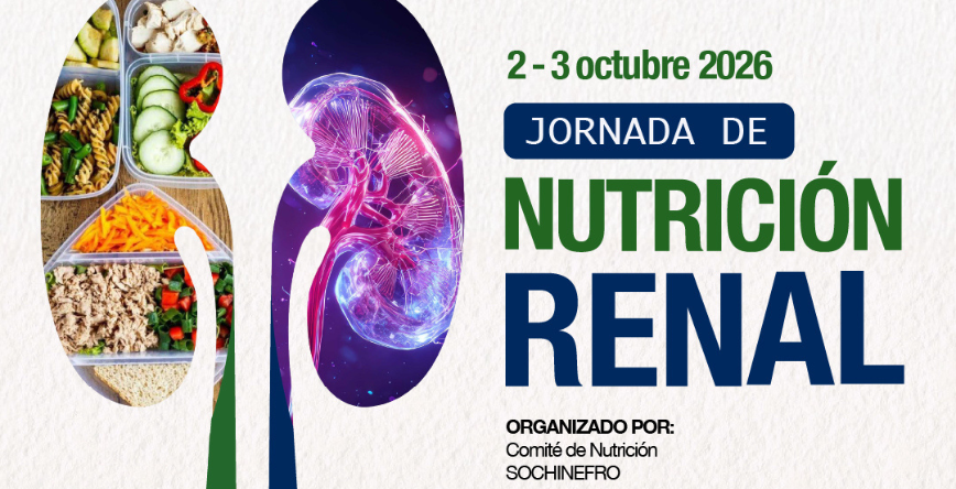 Evento