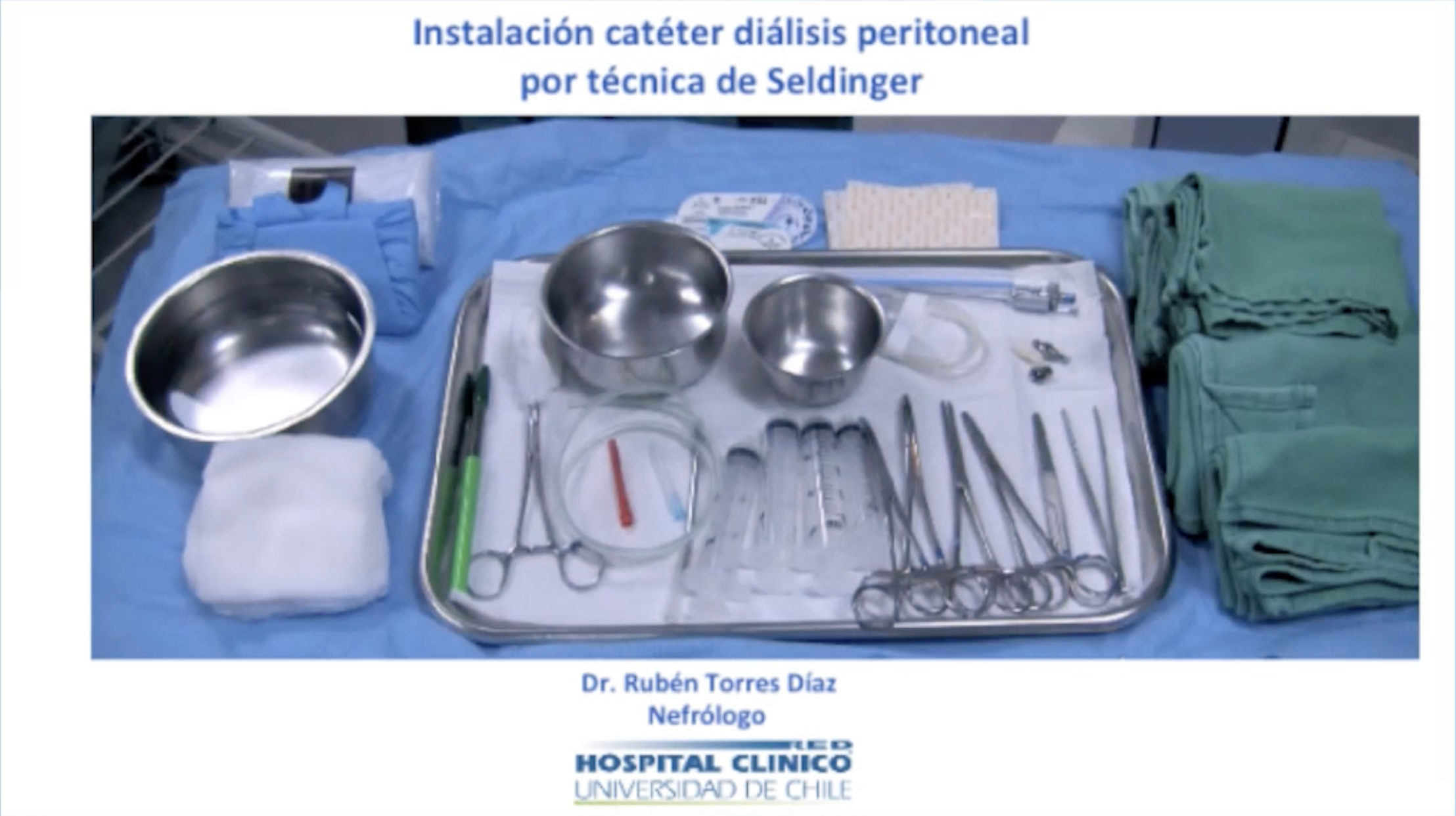 Instalación Catéter Diálisis Peritoneal por Técnica de Seldinger
