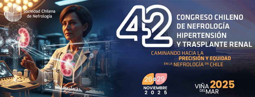 Evento