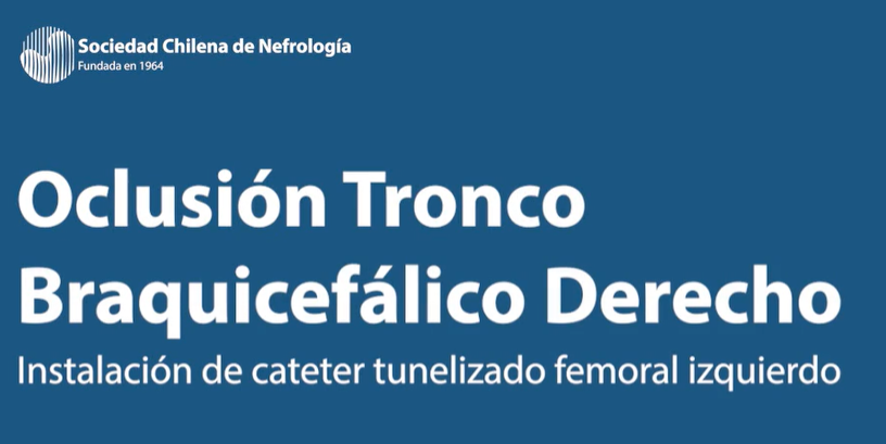 Oclusión Tronco