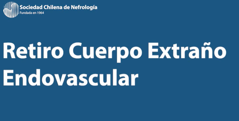 Retiro de cuerpo